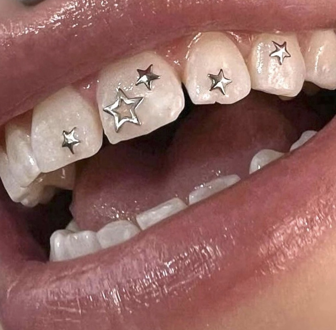 5pcs + 5pcs  Tooth Gem 5pcs 3mm Silver plated Rounded star & 5pcs  Hollow star 5mm Flatback