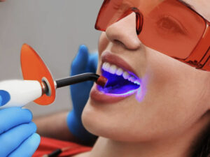 Rubyscraft® Professional UV Dentist Light Rechargeable Curing Cordless Light