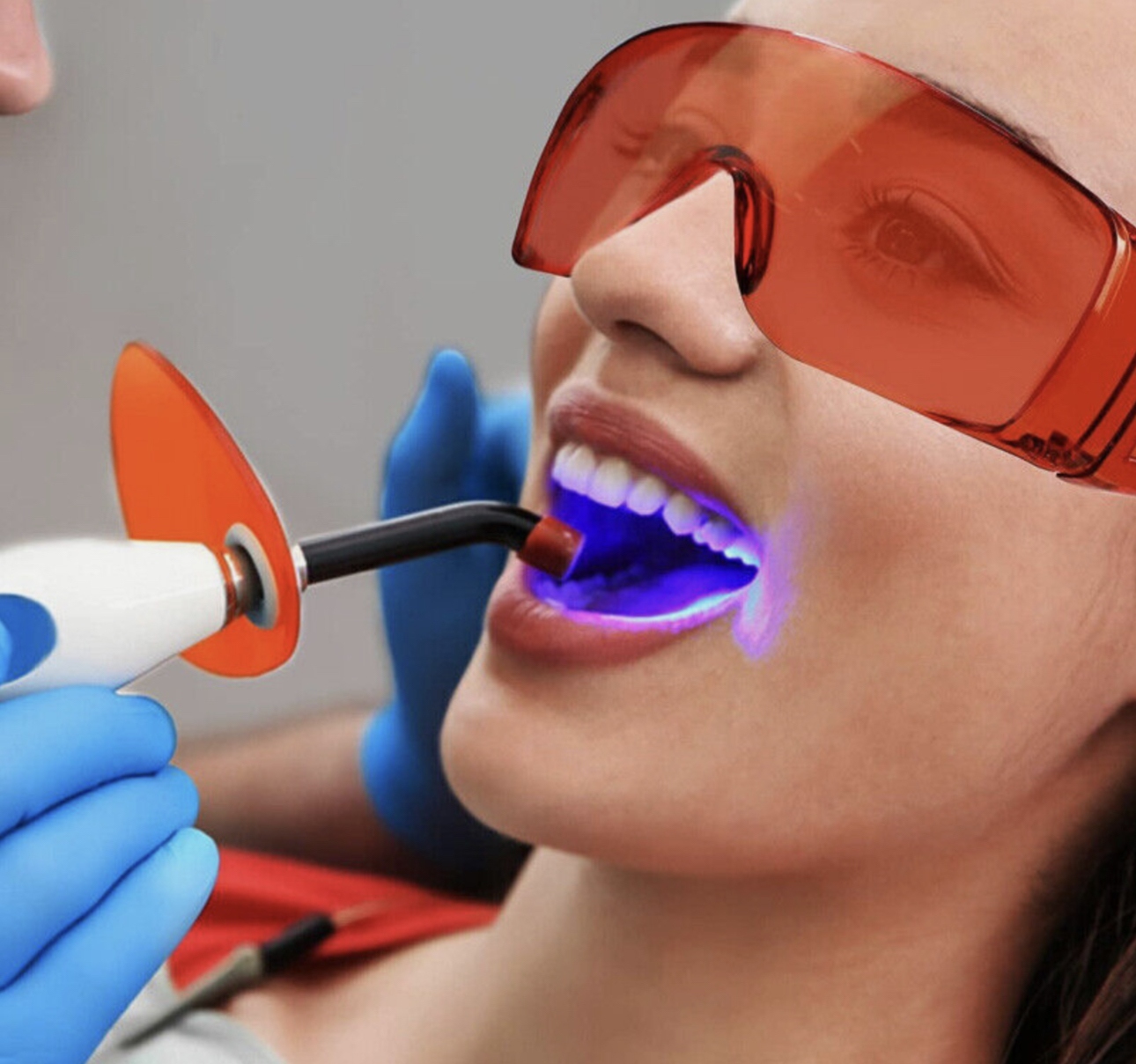 Rubyscraft® Professional UV Dentist Light Rechargeable Curing Cordless Light (Copy)