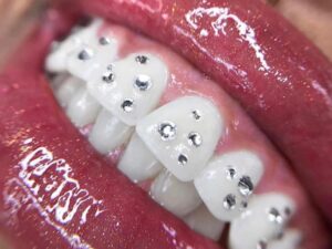 100pcs Mix Tooth Gem Swarovski® Wheel Mix Crystal ss3, ss4,ss6,ss7,ss8 Lead free Non hotfix foiled Rhinestone Flatback ref: 2058