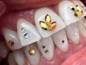 Alternative view of 10pcs Tooth Gems Preciosa® Aurum Gold Crystal Navette 2x4mm Lead-Free Gems Non hotfix foiled Austrian Rhinestones Flatbacks